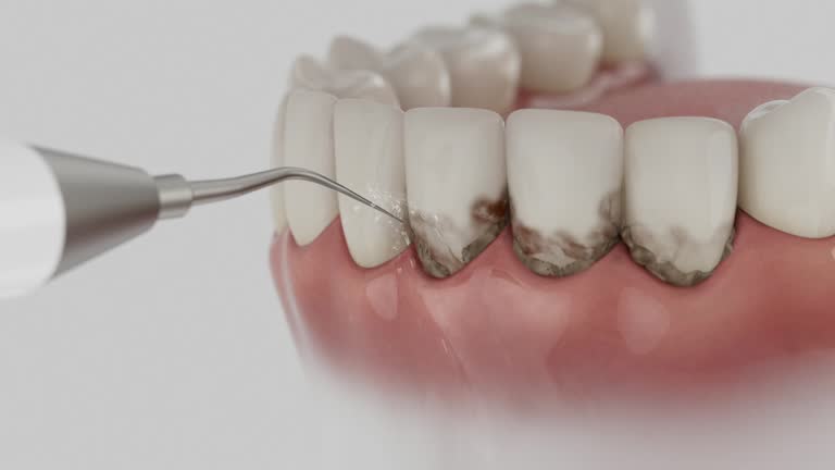 Reliable Dental contractor in Bellevue, ID by Dentist Open Now